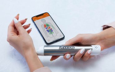 Radotech measure your health